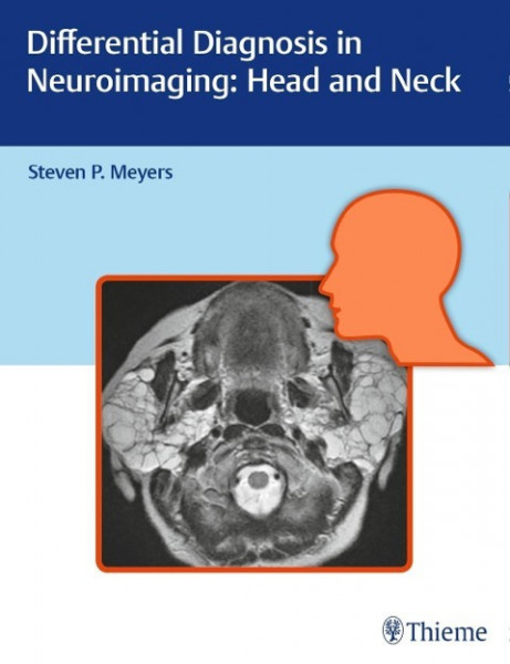 Differential Diagnosis in Neuroimaging