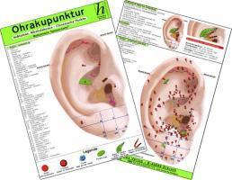 Ohrakupunktur - Indikation: Schulter-Arm-Syndrom - chinesische Ohrakupunktur