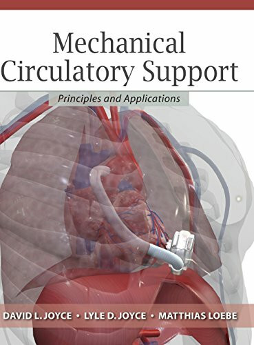 Mechanical Circulatory Support: Principles and Applications