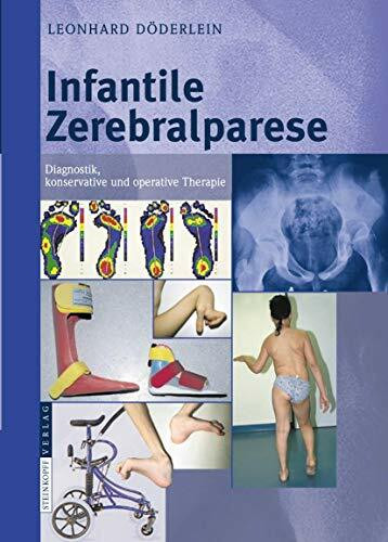 Infantile Zerebralparese: Diagnostik, konservative und operative Therapie