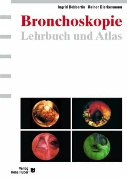 Lehrbuch und Atlas der Bronchoskopie: Geschichte, Techniken, Krankheitsbilder