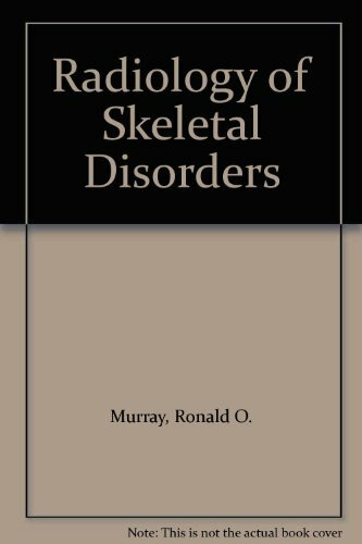Radiology of Skeletal Disorders