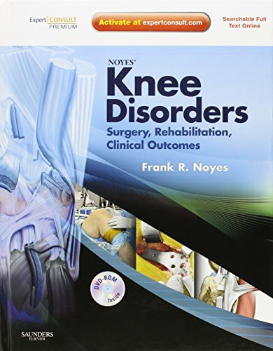 Noyes' Knee Disorders, w. DVD-ROM: Surgery, Rehabilitation, Clinical Outcomes. Expert Consult - Online, Print