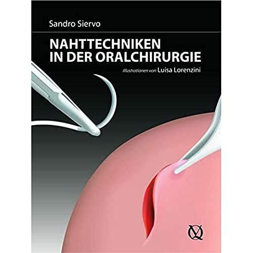 Nahttechniken in der oralen Chirurgie