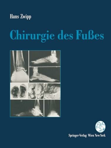 Chirurgie des Fußes Chirurgie des Fußes