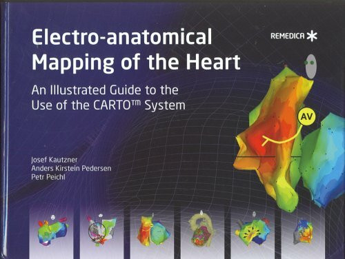 Electro-anatomical Mapping of the Heart