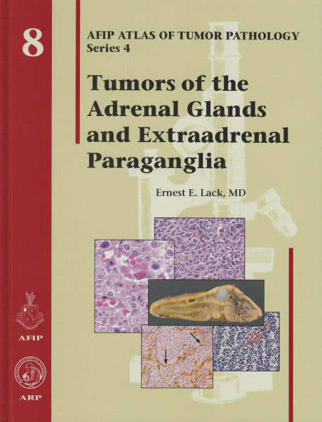 Tumors of the Adrenal Glands and Extraadrenal Paraganglia (Afip Atlas of Tumor Pathology, Band 4)