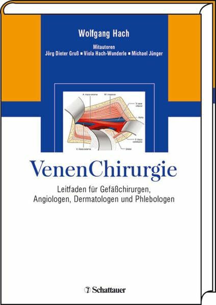 VenenChirurgie: Leitfaden für Gefässchirurgen, Angiologen, Dermatologen und Phlebologen