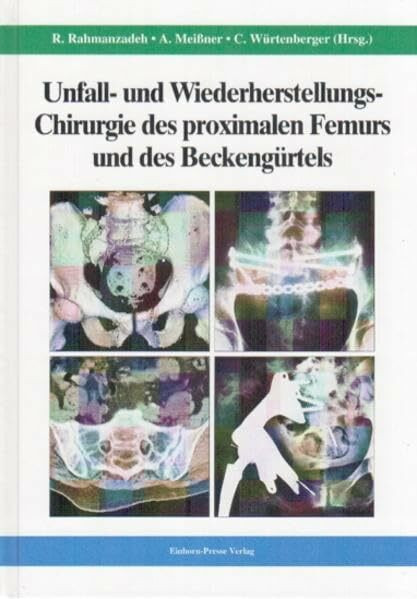 Unfall- und Wiederherstellungs-Chirurgie des proximalen Femurs und des Beckengürtels