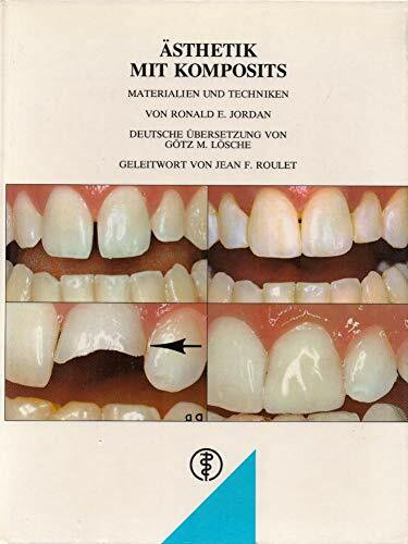 Ästhetik mit Komposits: Materialien und Techniken