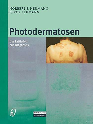 Photodermatosen. Ein Leitfaden zur Diagnostik
