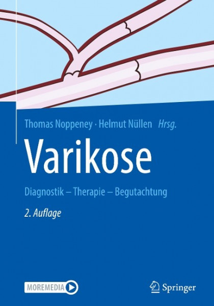 Varikose