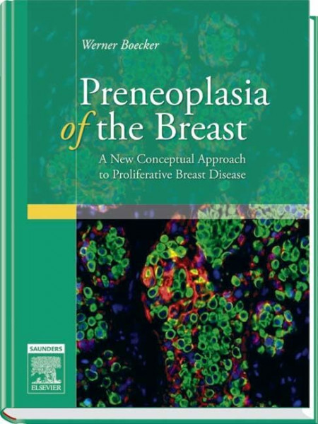 Preneoplasia of the Breast: A New Conceptual Approach to Proliferative Breast Disease