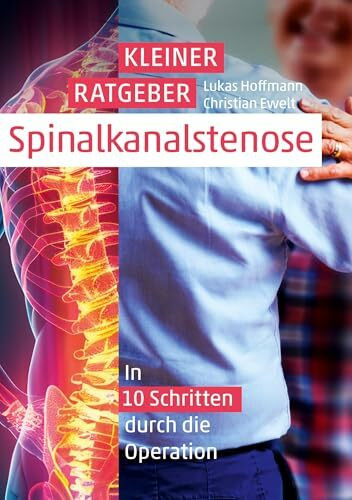 Kleiner Ratgeber Spinalkanalstenose: In 10 Schritten durch die Operation