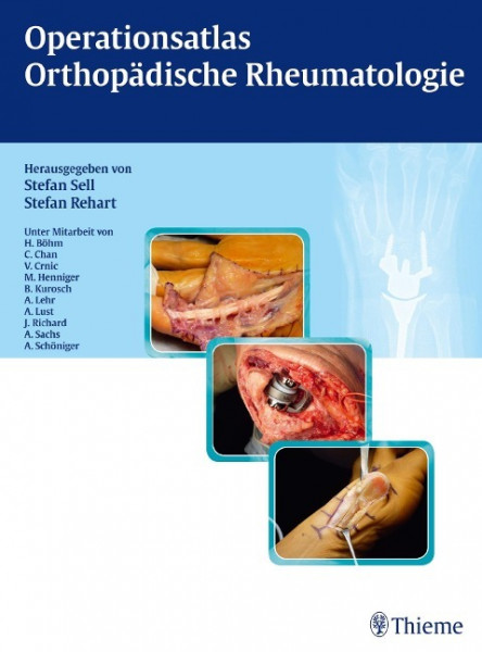 Operationsatlas Orthopädische Rheumatologie