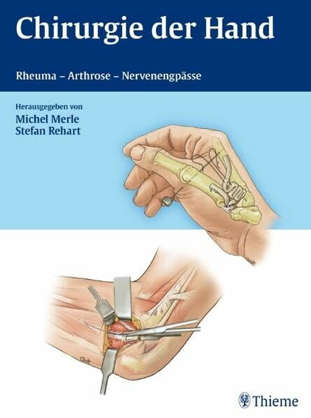 Chirurgie der Hand: Rheuma - Arthrose - Nervenengpässe