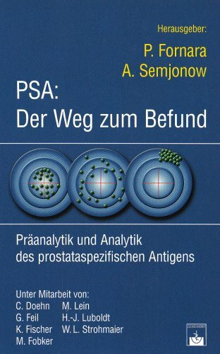 PSA: Der Weg zum Befund. Präanalytik und Analytik des prostataspezifischen Antigens