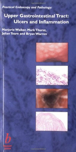Blackwell Science Ltd Upper Gastrointestinal Tract, Ulcers And Inflammation