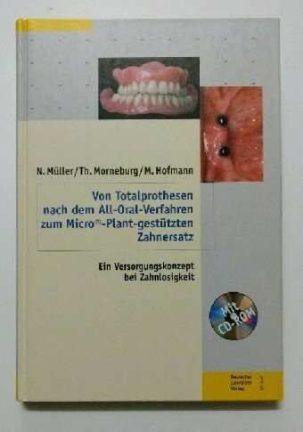 Von Totalprothesen nach dem All-Oral-Verfahren zum Micro©-Plant-gestützten Zahnersatz: Fachbuch mit einliegender CD-ROM