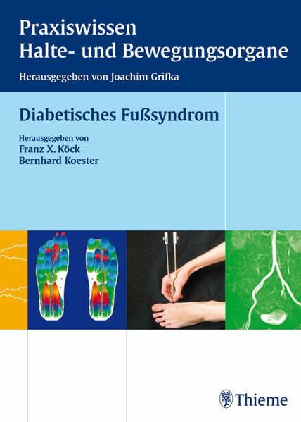Diabetisches Fußsyndrom (Reihe, Praxisw. Halte-Bew.)