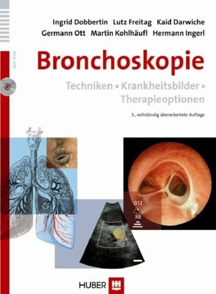 Bronchoskopie: Techniken • Krankheitsbilder • Therapieoptionen Bronchoskopie: Techniken • Krankheitsbilder • Therapieoptionen