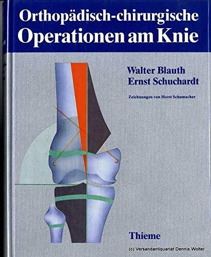 Orthopädisch-chirurgische Operationen am Knie