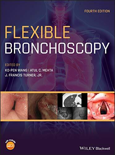 Flexible Bronchoscopy Flexible Bronchoscopy
