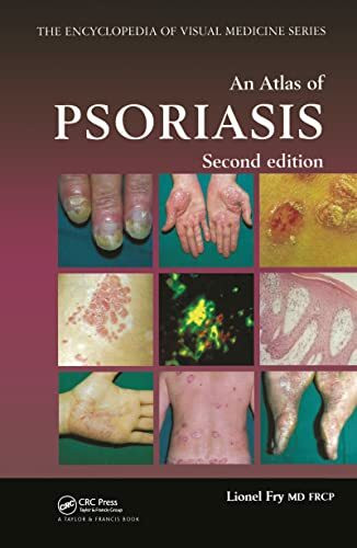 An Atlas of Psoriasis, Second Edition (Encyclopedia of Visual Medicine Series, 77)