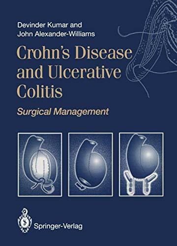 Crohn’s Disease and Ulcerative Colitis: Surgical Management Crohn’s Disease and Ulcerative Colitis: Surgical Management