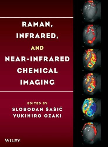 Raman, Infrared, and Near-Infrared Chemical Imaging