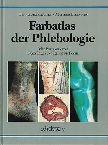 Farbatlas der Phlebologie