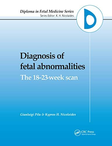 Taylor & Francis Ltd Diagnosis Of Fetal Abnormalities, The 18-23-Week Scan (Diploma In Fetal Medicine Series, 1, Ba...