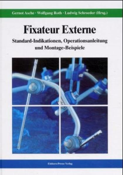 Fixateur Externe: Standard-Indikationen, Operationsanleitung und Montage-Beispiele