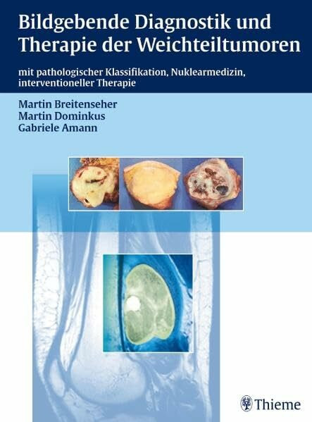 Bildgebende Diagnostik und Therapie der Weichteiltumoren: mit pathologischer Klassifikation, Nuklearmedizin, interventionelle Therapie: Mit ... Nuklearmedizin, interventioneller Therapie