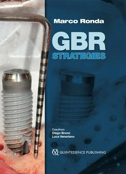 GBR Strategies