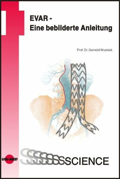 EVAR - Eine bebilderte Anleitung (UNI-MED Science)