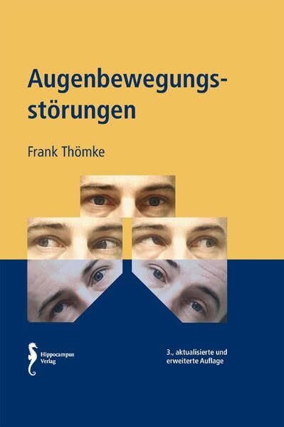 Augenbewegungsstörungen