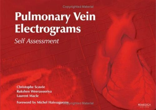 Pulmonary Vein Electrograms: Self Assessment