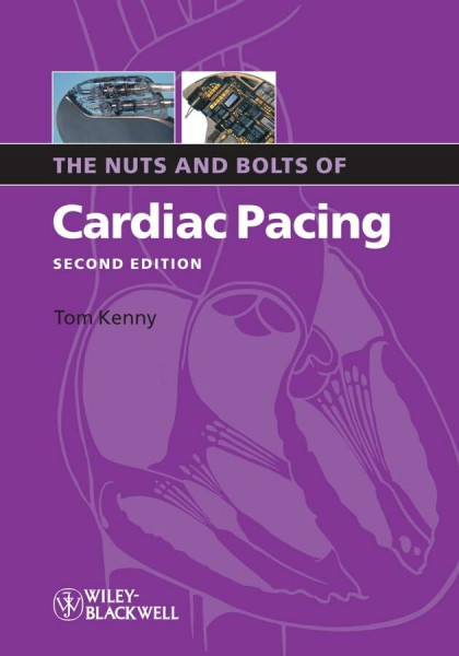 The Nuts And Bolts Of Cardiac Pacing (Nuts and Bolts S.)
