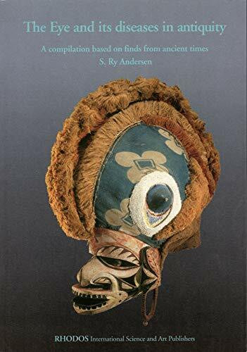 The eye and its diseases in antiquity. A compilation based on finds from ancient times.