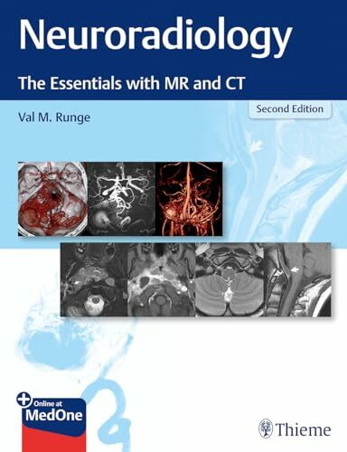 Neuroradiology: The Essentials with MR and CT