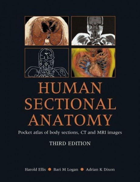 Human Sectional Anatomy: Pocket Atlas of Body Sections, CT and MRI Images