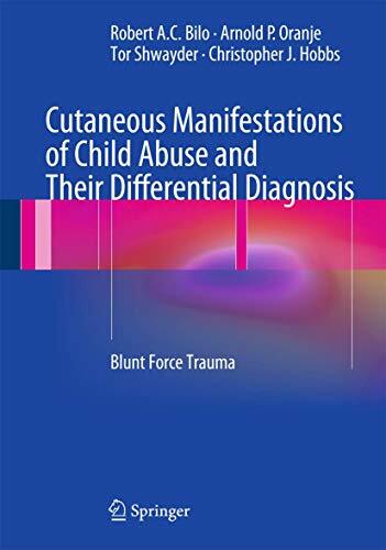 Cutaneous Manifestations of Child Abuse and Their Differential Diagnosis: Blunt Force Trauma Cutaneous Manifestations of Child Abuse and Their Differential Diagnosis: Blunt Force Trauma