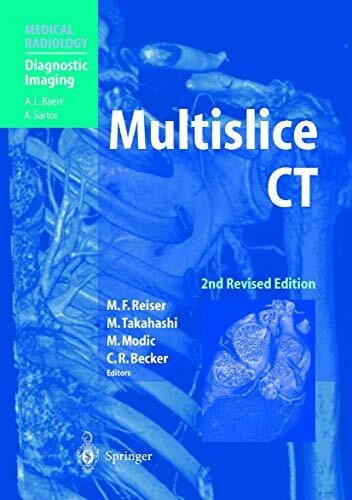 Multislice CT (Diagnostic Imaging)