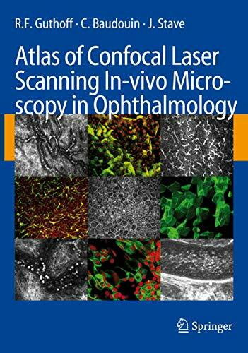 Atlas of Confocal Laser Scanning In-vivo Microscopy in Ophthalmology: Principles and Applications in Diagnostic and Therapeutic Ophtalmology