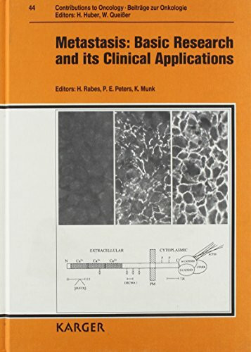 Beiträge zur Onkologie /Contributions to Oncology / Metastis: Basic Research and Its Clinical Application: 8th International Expert Meeting of the Dr. ... für Krebsforschung, Bonn, October 1991