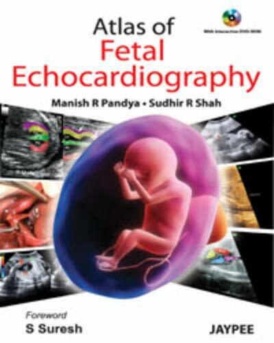 Atlas of Fetal Echocardiography Atlas of Fetal Echocardiography