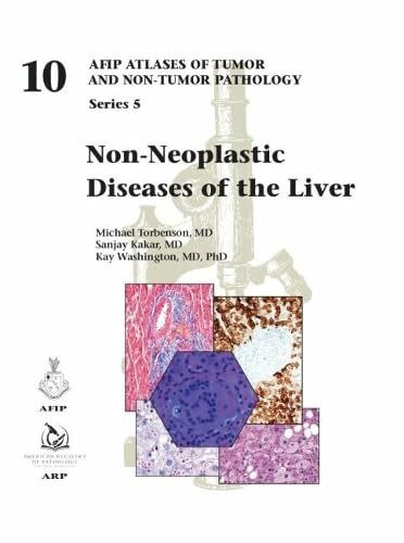 Non-Neoplastic Diseases of the Liver (AFIP Atlas of Tumor and Non-Tumor Pathology, Series 5, Band 10)