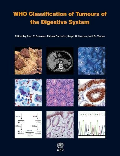 WHO Classification of Tumours of the Digestive System: WHO Classification of Tumours, Volume 3 (World Health Organization Classification of Tumours, 3, Band 3)