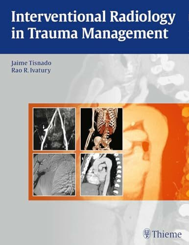 Interventional Radiology in Trauma